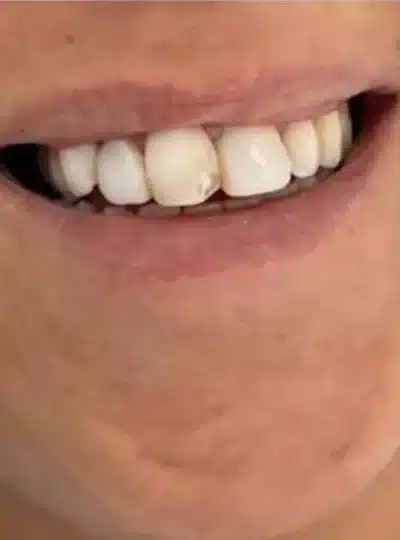 1.1