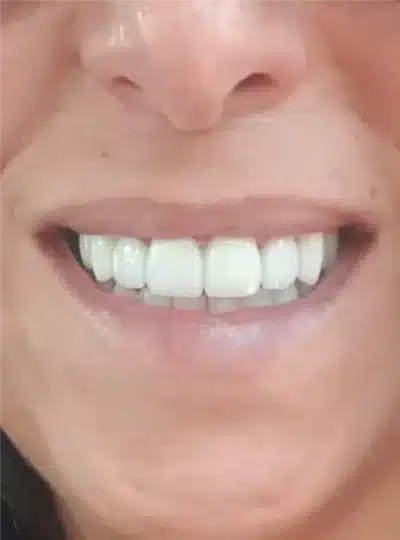 1.2
