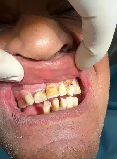 3.1