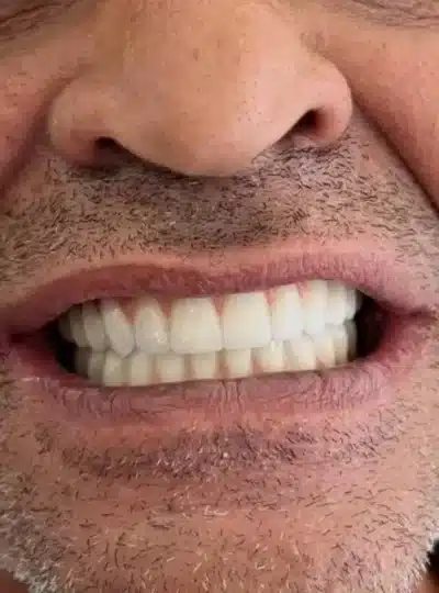 3.2